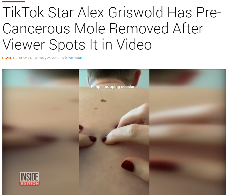 Alex Griswold TikTok Cancerous Mole Jeff J Hunter